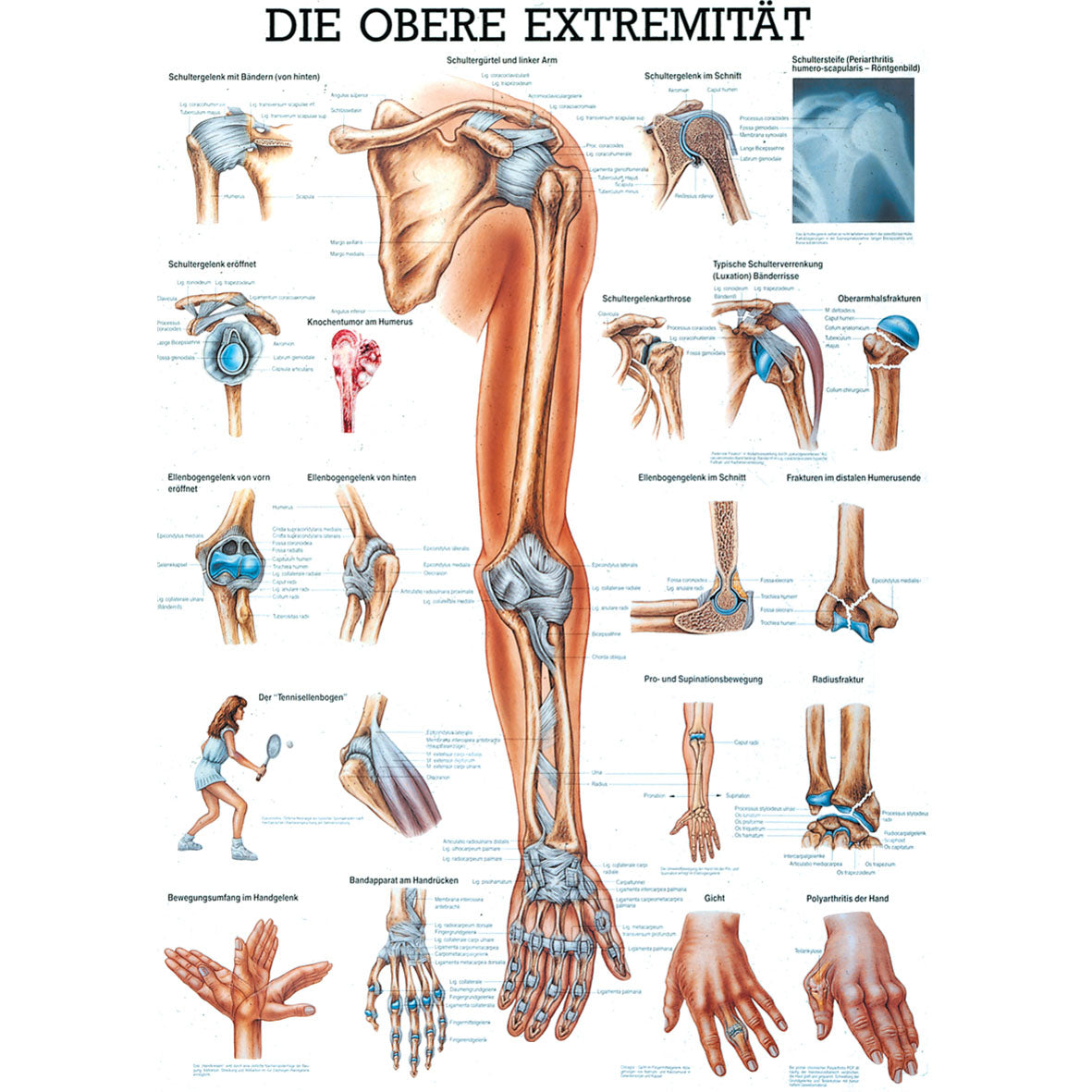 Anatomisches Miniposter "Die obere Extremität"