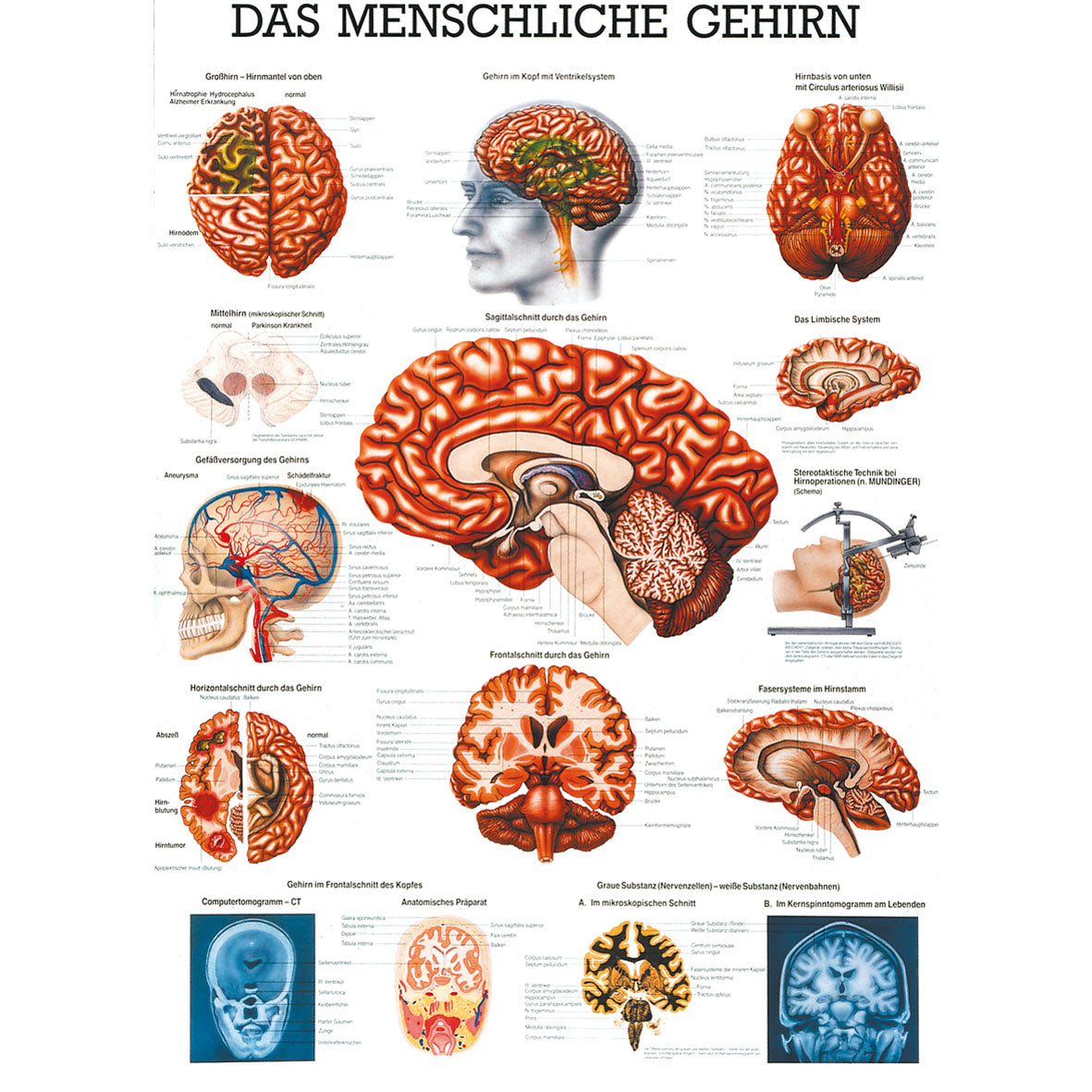 Anatomisches Poster "Das menschliche Gehirn"