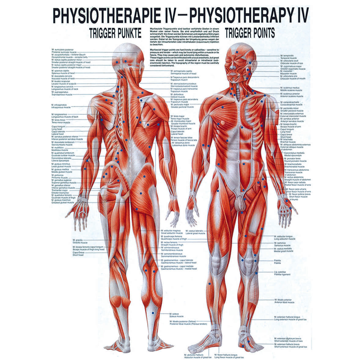 Anatomisches Miniposter "Triggerpunkte"