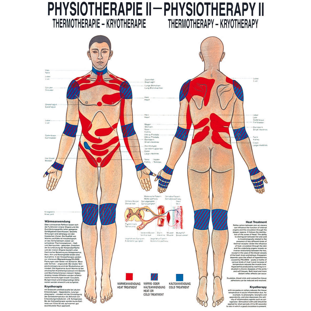 Anatomisches Miniposter "Physiotherapie II - Thermotherapie"