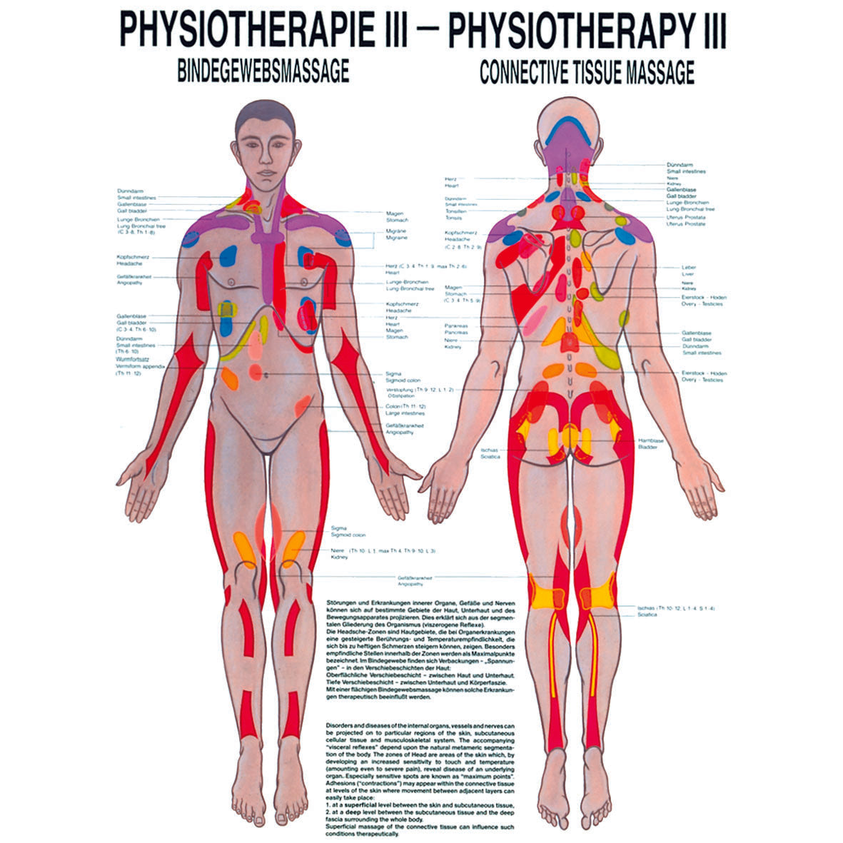 Anatomisches Miniposter "Physiotherapie III - Bindegewebsmassage"