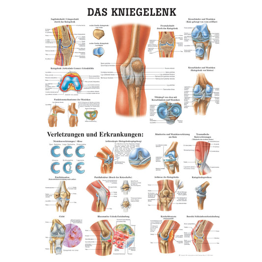 Anatomisches Poster "Das Kniegelenk"