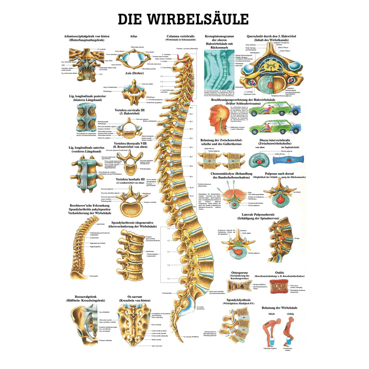 Anatomisches Miniposter "Die Wirbelsäule"